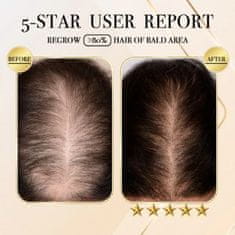 Mormark Zázvorový šampón na vlasy, šampon na růst a regeneraci vlasů | SHAMWOO