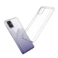 IZMAEL Pouzdro Ultra Clear pro Samsung Galaxy M31S - Transparentní KP9389
