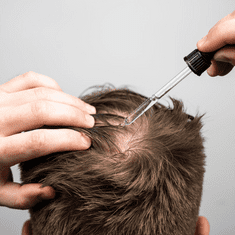 Bio-Pilixin Activation Serum pro zpomalení vypadávání a podporu růstu vlasů pro muže 100 ml