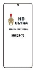 HD Ultra Fólie Honor 70 105387