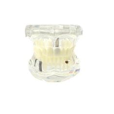 Verk 01964 Model zubních implantátů bílá