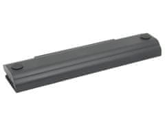 Avacom Náhradní baterie Lenovo ThinkPad E550 76+ Li-Ion 10,8V 5200mAh