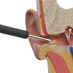 MXM Bezdrátový wifi ušní endoskop na čištění uší - Bebird C3