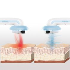 InnovaGoods Ultrazvukový kavitační masážní přístroj na celulitidu 3v1 CellyMax