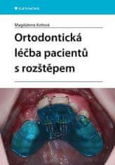 Koťová Magdalena: Ortodontická léčba pacientů s rozštěpem