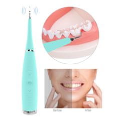 FRILLA® Ultrazvukový čistič zubů SMILY + V34 Korekční barevné sérum JOYTEETH | TEETHLY
