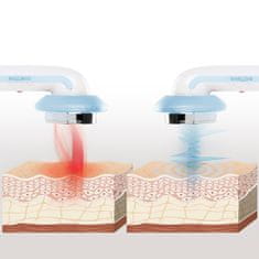 InnovaGoods Ultrazvukový kavitační anticelulitidní masážní přístroj 3 v 1 s infračerveným zářením a elektrostimulací CellyMax InnovaGoods 