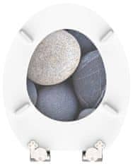 Eisl Wc sedátko Grey stones MDF se zpomalovacím mechanismem SOFT-CLOSE