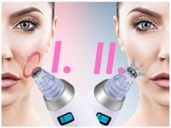 BeautyRelax Kosmetický přístroj na abrazi pleti Peelmax