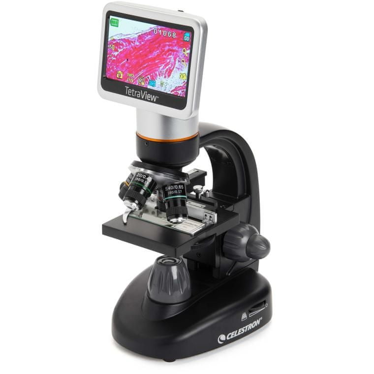Levně Celestron mikroskop TetraView 4,3″ LCD 40-1600× (44347)
