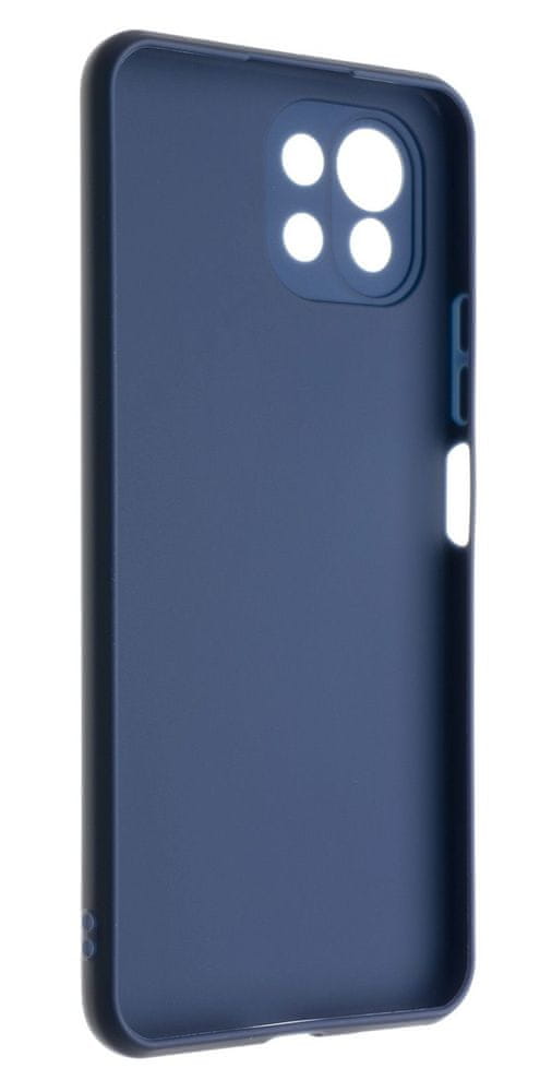 FIXED Zadní pogumovaný kryt Story pro Xiaomi Mi 11 Lite/Mi 11 Lite 5G FIXST-679-BL, modrý