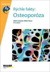 Juliet Compston: Rýchle fakty: Osteoporóza - Prvé vydanie