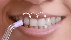 Tehnologija pulznega doplerja vas vodi od zoba do zoba