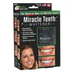 commshop Přírodní uhlí pro bělení zubů - Miracle Teeth