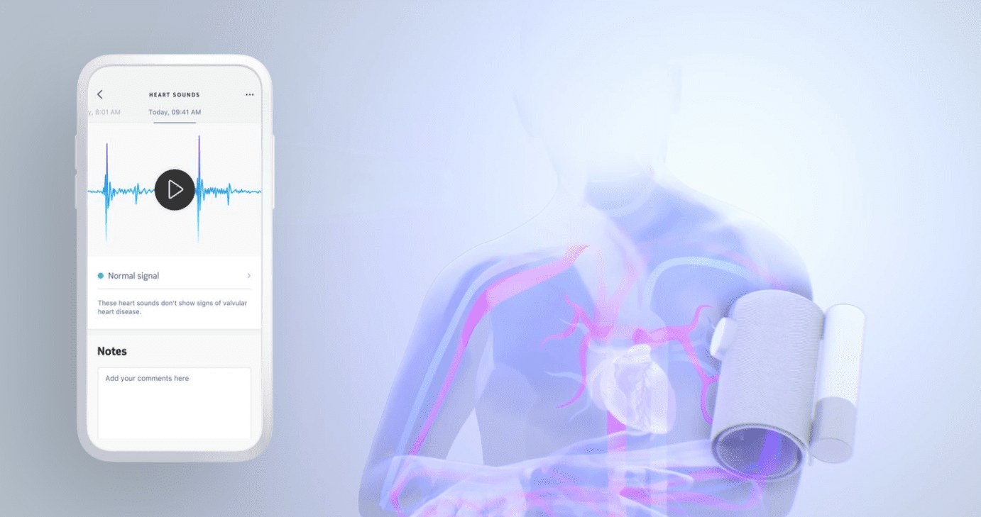 Digitalni stetoskop - odkrijte bolezen srčnih zaklopk