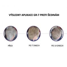 GR-7 Professional SET GR-7 proti šedinám: Tonikum + šampon pro podporu růstu vlasů a k obnově vlasového barviva + Antistatický masážní hřeben zdarma