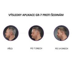 GR-7 Professional SET GR-7 proti šedinám: Tonikum + šampon pro podporu růstu vlasů a k obnově vlasového barviva + Antistatický masážní hřeben zdarma