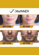 JAWINNER WINBUILDERS - FULLPACK / Obličejový toner / Pomůcky pro korekci podbradku a čelistí 