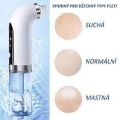 BeautyRelax Kosmetický přístroj na čištění pleti Poremax Oxygen